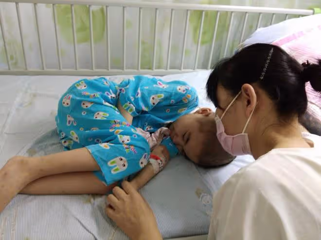 血癌女童結療後復發,移植排異奇癢難受突然拔掉picc管,父母嚇呆
