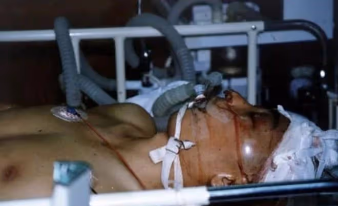 1996年押款車大劫案,主犯比白寶山狠,為何未審判就死在醫院?