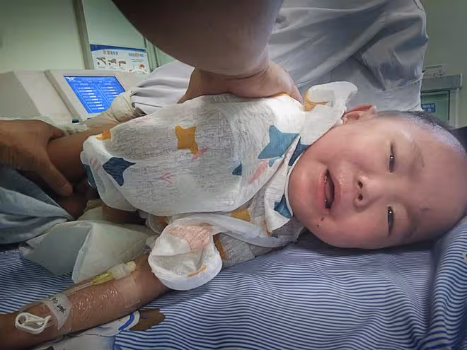 男娃咳嗽查出罕見重病陷入昏迷,父母絕望準備帶他回家,孩子醒了