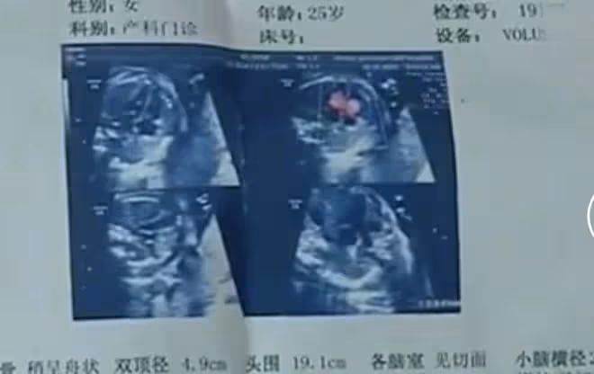 回顧:丈夫婚內出軌,小三懷孕6個月,妻子爆發,雙方大打出手
