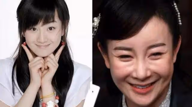 迫於壓力整容,清冷美人面目全非,35歲回頭演女配,臉上毫無表情