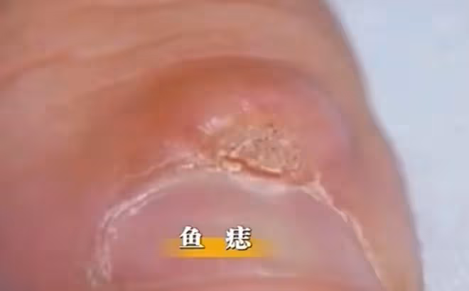 2019年男子患上怪病,身上長滿「樹枝」,散發的氣味讓人永生難忘