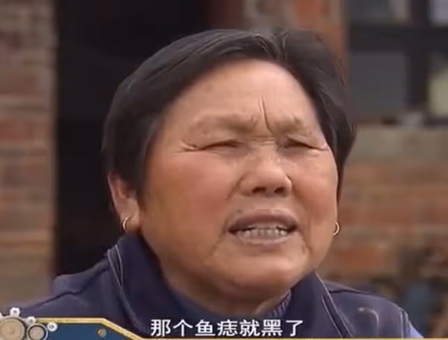 2019年男子患上怪病,身上長滿「樹枝」,散發的氣味讓人永生難忘