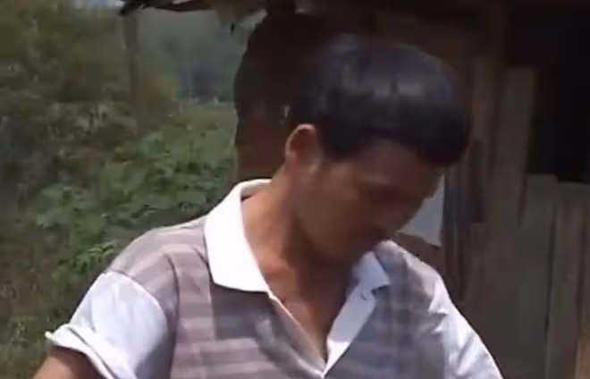 2019年男子患上怪病,身上長滿「樹枝」,散發的氣味讓人永生難忘