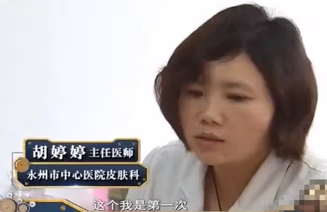 2019年男子患上怪病，身上長滿「樹枝」，散發的氣味讓人永生難忘