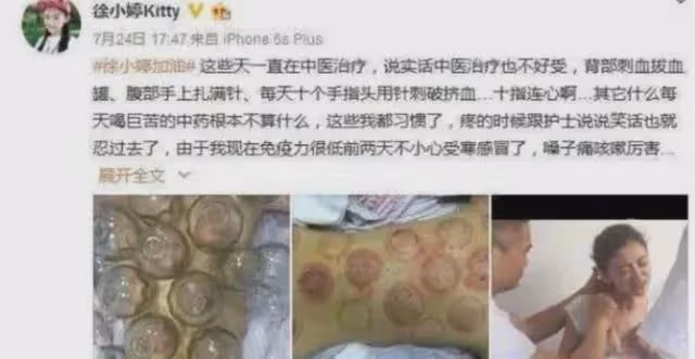 原來她早已去世!被全家8口吸血多年,26歲全身潰爛不治而亡
