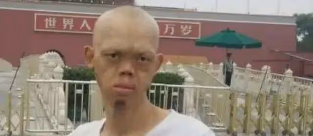 「妖魔專業戶」李平安：長相怪異卻抱得美人歸，癩蛤蟆吃到天鵝肉