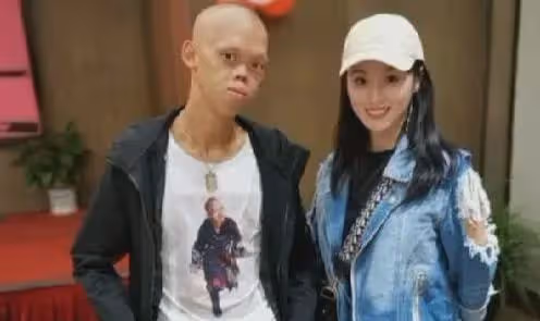 「妖魔專業戶」李平安:長相怪異卻抱得美人歸,癩蛤蟆吃到天鵝肉