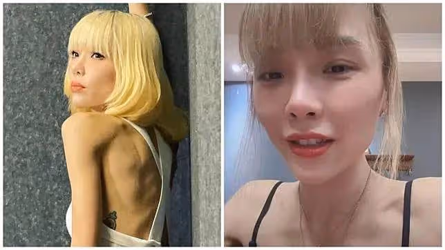 香港女歌手離婚仍未走出情傷,身形暴瘦疑患厭食症,亮相TVB被網友吐槽