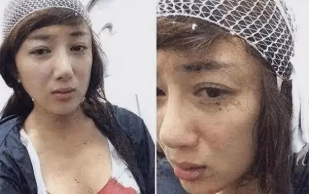 她曾是古裝第一美人,被狗咬毀容後,如今40歲靠演壞女人翻身