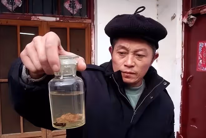 回顧男子昏迷19天患上怪病,25年後醫生從他腦中取出異物,快報警