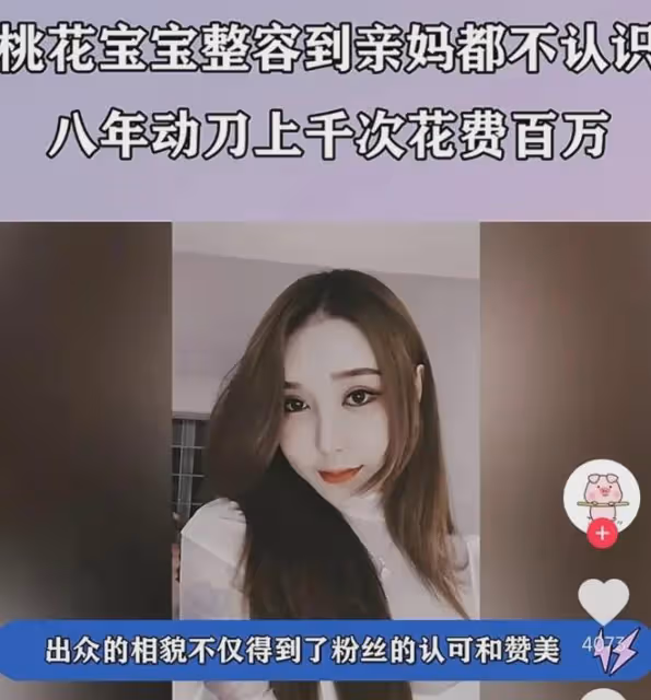 網紅桃花寶寶花240萬整容失敗,眼睛抽搐屁股化膿,網友直呼辣眼
