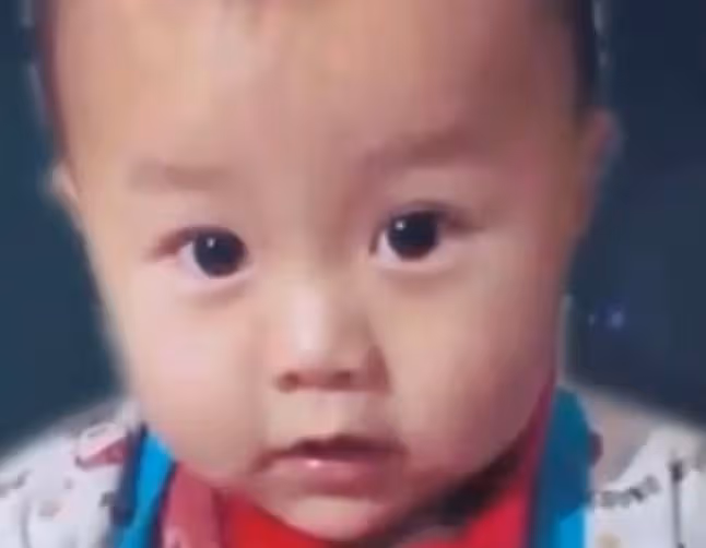 2015年1歲男童鼻涕不止,醫生檢查後發現,腦部竟插入7厘米筷子