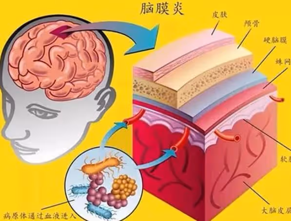 2015年1歲男童鼻涕不止,醫生檢查後發現,腦部竟插入7厘米筷子