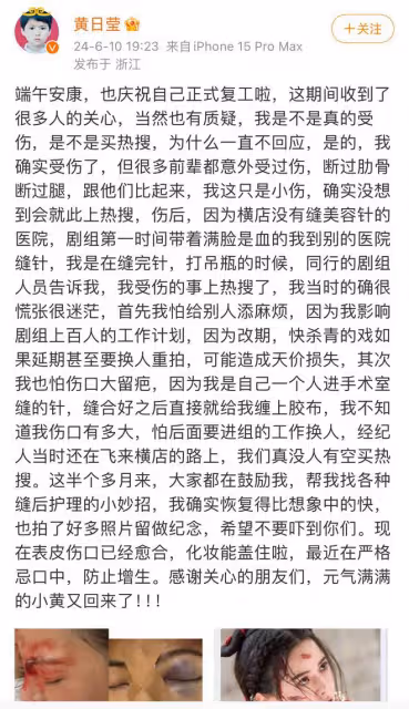 黃日瑩回應臉部受傷縫針一事，曬的傷口照有點嚇人，看起來很嚴重