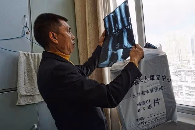 回顧弟弟意外去世,哥哥娶弟媳為妻,婚後倆人生下天生殘疾的女兒