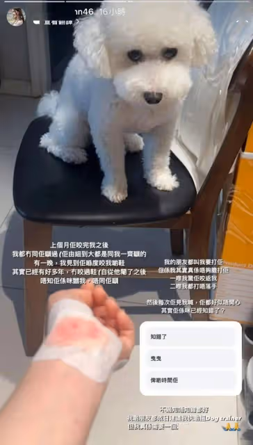 TVB小花被「同居者」咬傷就醫!爆對方被閹:是不是恨我