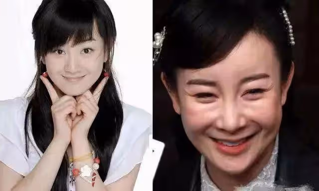 鞠婧禕近照變樣,金莎臉僵浮腫,這6位明星動臉後遺症都出來了