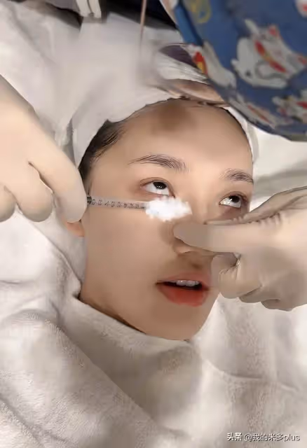 林允又往臉上扎針,打水光+膠原蛋白直喊疼,才28歲就依賴醫美