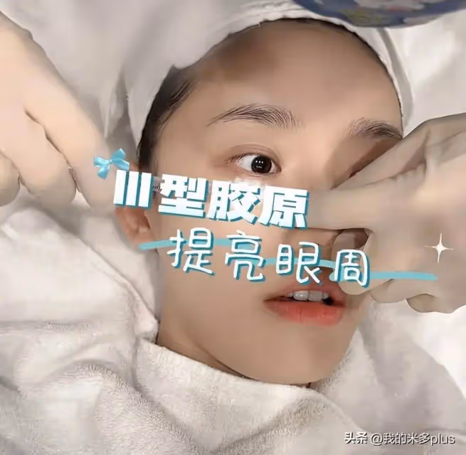 林允又往臉上扎針,打水光+膠原蛋白直喊疼,才28歲就依賴醫美