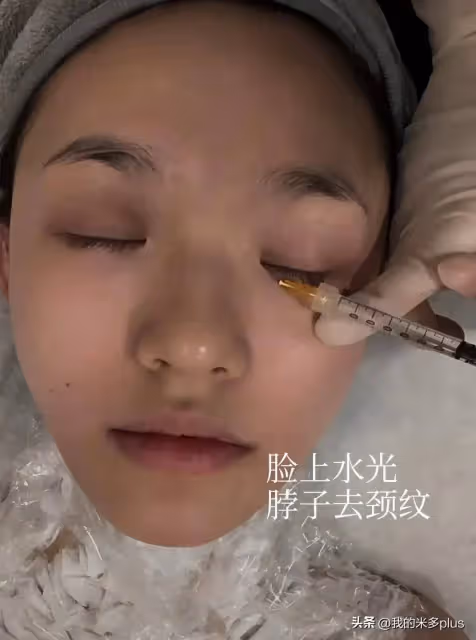 林允又往臉上扎針,打水光+膠原蛋白直喊疼,才28歲就依賴醫美