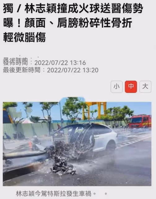 林志穎花300萬修復面容後遺症曝光,顏值巔峰真的回不來了嗎?