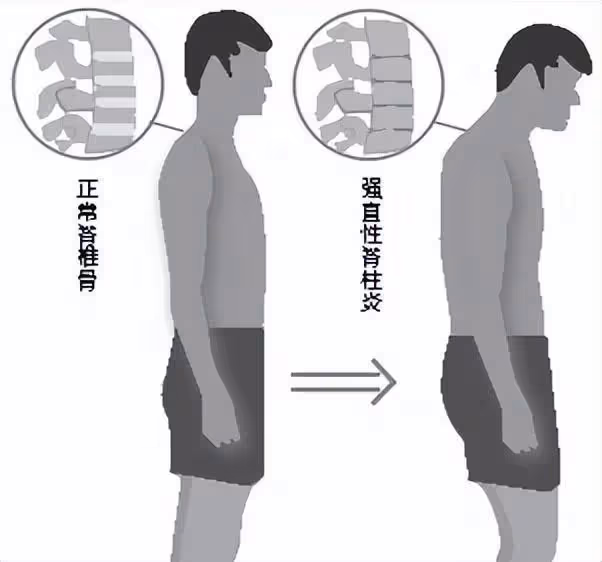 回顧:男子癱瘓後妻子離開,他含淚將女兒送人,女兒稱爸爸我不要