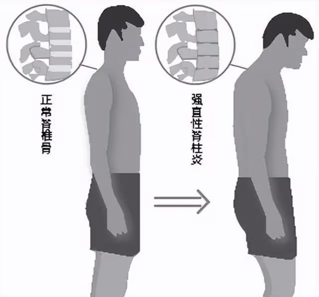 回顧:19年男子癱瘓妻子離開,無奈將女兒送人,女兒哀求別不要我