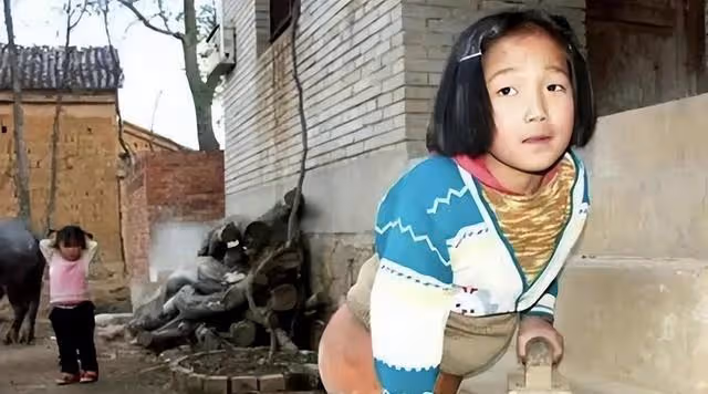 回顧:她4歲失去雙腿靠半個籃球走路!曾經那個小女孩如今怎樣了