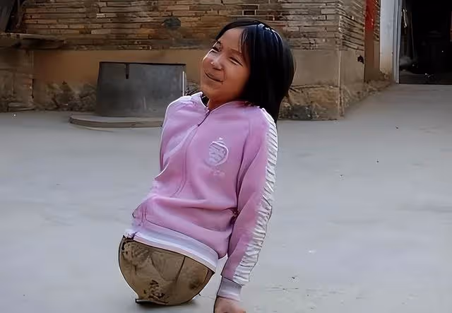 回顧：她4歲失去雙腿靠半個籃球走路！曾經那個小女孩如今怎樣了