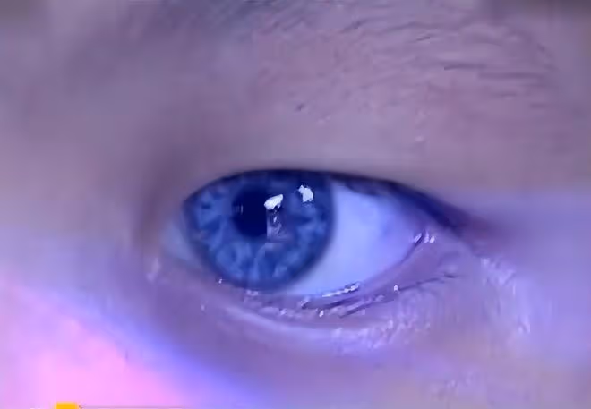 回顧男童天生擁有藍眼,夜晚看東西如同白天,檢查結果讓全家沉默