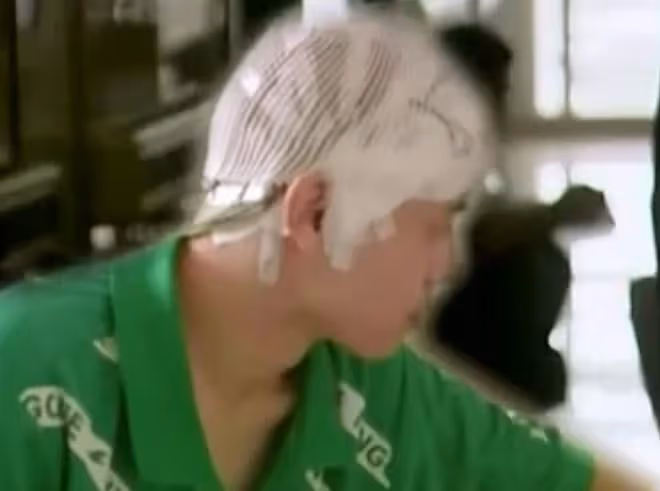 2012年,22歲小伙經常昏倒在地,醫生檢查發現:大腦里有兩顆子彈