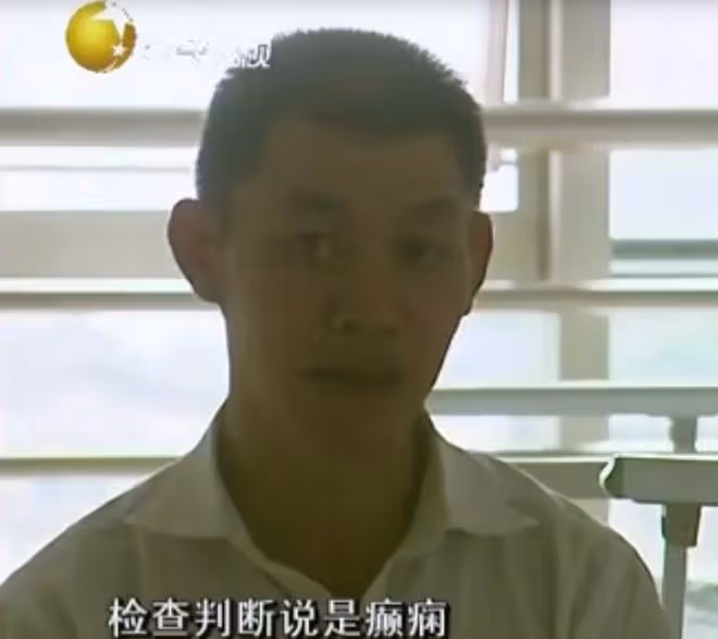 2012年,22歲小伙經常昏倒在地,醫生檢查發現:大腦里有兩顆子彈