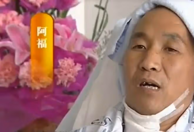 2011年,雲南男子頭疼嘔吐身上惡臭,檢查發現腦中竟插著一把匕首