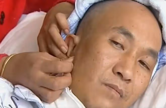 2011年,雲南男子頭疼嘔吐身上惡臭,檢查發現腦中竟插著一把匕首