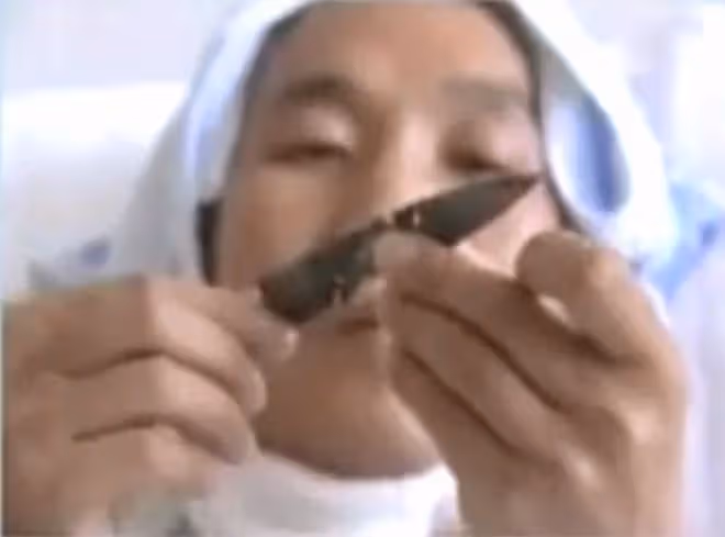 2011年,雲南男子頭疼嘔吐身上惡臭,檢查發現腦中竟插著一把匕首