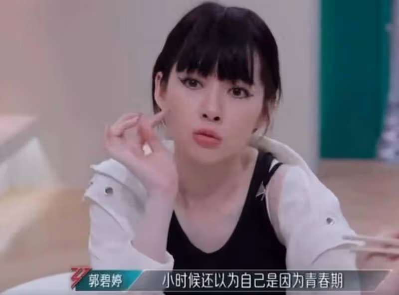 郭碧婷自曝對白米飯過敏!吃了會有臉上長爛痘嘴巴潰瘍等狀況