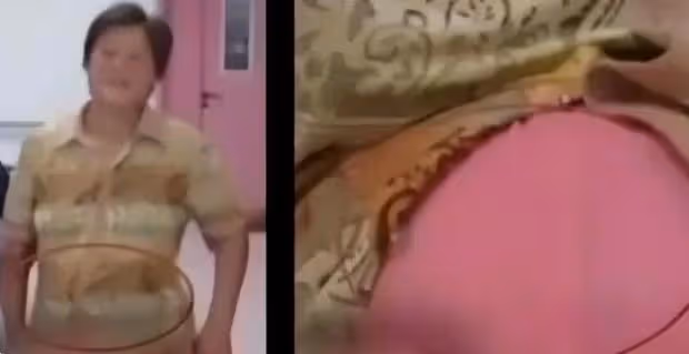 女子剛出月子,竟發現「肚裡還有一子」,醫生:當時明明只有一個