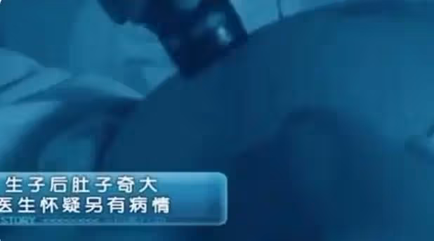 女子剛出月子,竟發現「肚裡還有一子」,醫生:當時明明只有一個