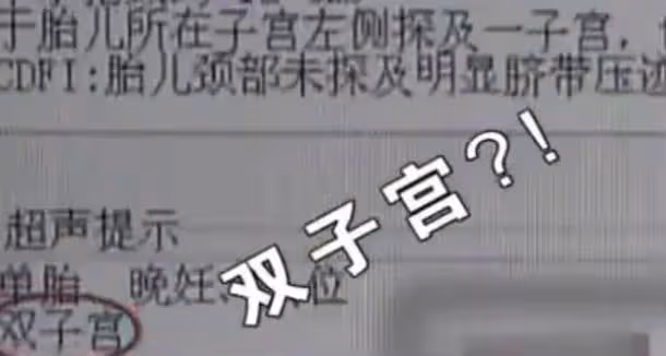女子剛出月子,竟發現「肚裡還有一子」,醫生:當時明明只有一個
