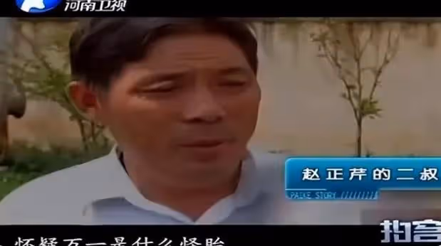 女子剛出月子,竟發現「肚裡還有一子」,醫生:當時明明只有一個