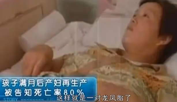 女子剛出月子,竟發現「肚裡還有一子」,醫生:當時明明只有一個