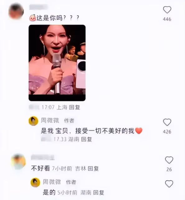 大姐你誰啊？這幾個明星整容前後變化大，簡直不敢認！
