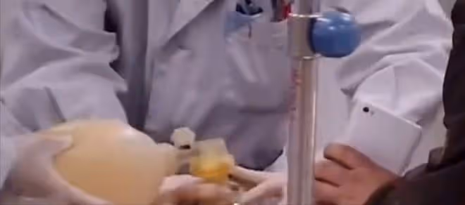 回顧老人突發疾病，心臟停跳醫生也無能為力，自閉症孫子創造奇蹟