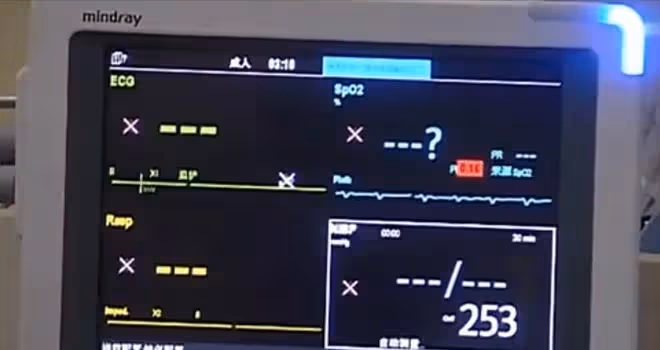 回顧老人突發疾病，心臟停跳醫生也無能為力，自閉症孫子創造奇蹟