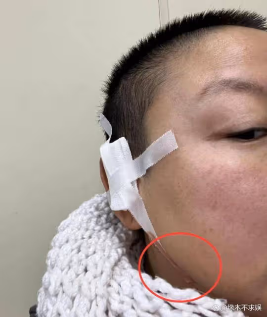 《好聲音》學員王韻壹去世！友人公布去世原因，最後朋友圈見端倪