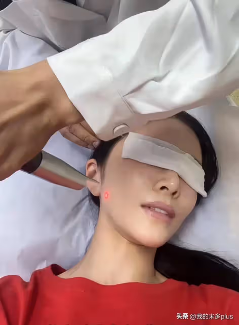 杜淳老婆去醫院做美容,王燦大方曬雷射美白過程,自誇皮膚好到爆