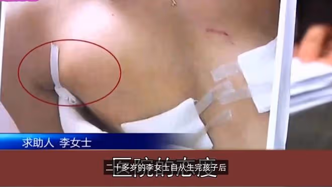 女子割雙眼皮失敗,無理取鬧要槍斃醫生,網友看過照片後:斃了