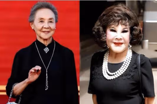 整容老去和自然老去,差別到底有多大?對比這7位明星你就明白了