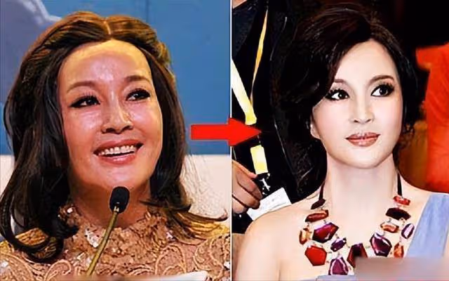 整容老去和自然老去,差別到底有多大?對比這7位明星你就明白了